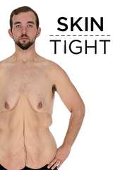 Poster for My 600-lb Life: Skin Tight (2018)